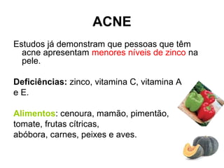 ACNE
Estudos já demonstram que pessoas que têm
acne apresentam menores níveis de zinco na
pele.
Deficiências: zinco, vitamina C, vitamina A
e E.
Alimentos: cenoura, mamão, pimentão,
tomate, frutas cítricas,
abóbora, carnes, peixes e aves.
 
