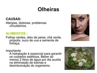Olheiras
CAUSAS:
Alergias, disbiose, problemas
circulatórios.
ALIMENTOS :
Folhas verdes, óleo de peixe, chá verde,
própolis, suco de uva e semente de
linhaça.
Importante:
A hidratação é essencial para garantir
os cuidados estéticos. Beber ao
menos 2 litros de água por dia auxilia
na eliminação de toxinas e
desintoxicação do organismo.
 