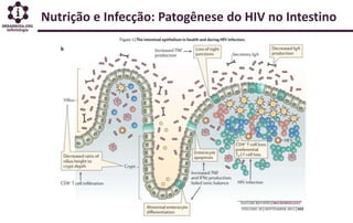 Nutrição e Infecção: Patogênese do HIV no Intestino
 