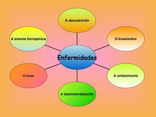 A anemia ferropénica O bocio A desmineralización A avitaminosis O kwasiorkor A desnutrición Enfermidades 