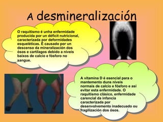 A  desmineralización O raquitismo é unha enfermidade producida por un déficit nutricional, caracterizada por deformidades esqueléticas. É causado por un descenso da mineralización dos ósos e cartílagos debido a niveis baixos de calcio e fósforo no sangue.   A vitamina D é esencial para o mantemento duns niveis normais de calcio e fósforo e así evitar esta enfermidade. O raquitismo clásico, enfermidade carencial da infancia caracterizada por desenvolvemento inadecuado ou fragilización dos ósos. 