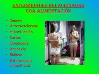 Enfermidades relacionadas coa alimentación Cancro Arteriosclerose Hipertensión Caries Obesidade Anorexia Bulimia Intolerancia alimenticias 