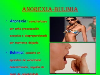 Anorexia-bulimia Anorexia:  caracterízase por unha preocupación excesiva e desproporcionada por manterse delgada. Bulimia:  consiste en episodios de voracidade descontrolada, seguida de dosis de culpabilidade. 