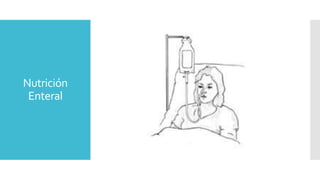 Nutrición
Enteral
 