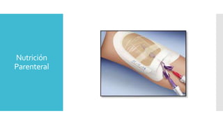 Nutrición
Parenteral
 