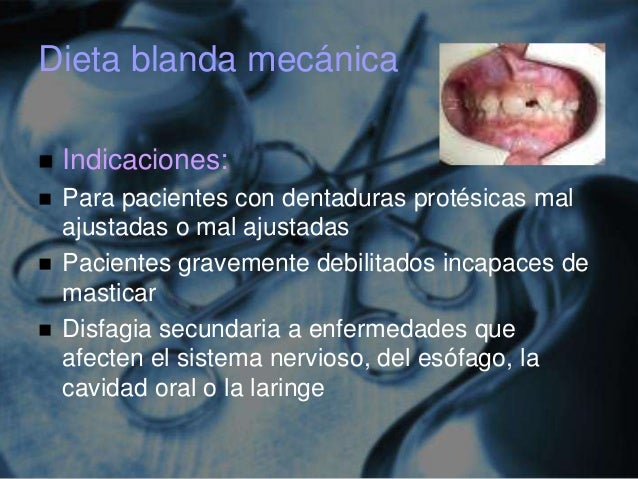 Nutrición en el paciente quirúrgico (con material extra) Nutrición en el paciente quirúrgico (con material extra)