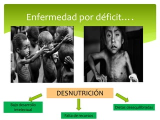 Enfermedad por déficit….
DESNUTRICIÓN
Bajo desarrollo
intelectual
Falta de recursos
Dietas desequilibradas
 