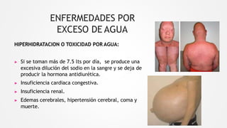 ENFERMEDADES POR
EXCESO DE AGUA
HIPERHIDRATACION O TOXICIDAD POR AGUA:
▶ Si se toman más de 7.5 lts por día, se produce una
excesiva dilución del sodio en la sangre y se deja de
producir la hormona antidiurética.
▶ Insuficiencia cardiaca congestiva.
▶ Insuficiencia renal.
▶ Edemas cerebrales, hipertensión cerebral, coma y
muerte.
 