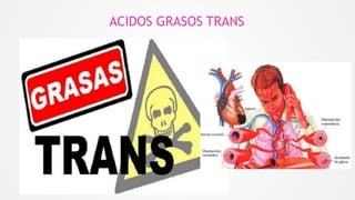 ACIDOS GRASOS TRANS
 