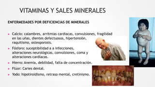 VITAMINAS Y SALES MINERALES
ENFERMEDADES POR DEFICIENCIAS DE MINERALES
▶ Calcio: calambres, arritmias cardiacas, convulsiones, fragilidad
en las uñas, dientes defectuosos, hipertensión,
raquitismo, osteoporosis.
▶ Fósforo: suceptibilidad a a infecciones,
alteraciones neurológicas, convulsiones, coma y
alteraciones cardíacas.
▶ Hierro: Anemia, debilidad, falta de concentración.
▶ Flúor: Caries dental.
▶ Yodo: hipotiroidismo, retraso mental, cretinismo.
 