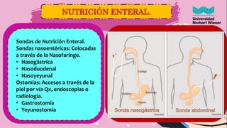 NUTRICIÓN ENTERAL.
Sondas de Nutrición Enteral.
Sondas nasoentéricas: Colocadas
a través de la Nasofaringe.
• Nasogástrica...