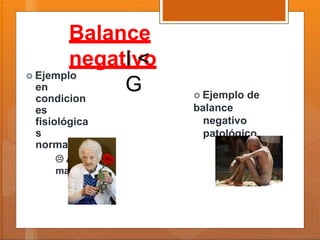 Balance
negativoI <
G  Ejemplo de
balance
negativo
patológico

Desnutrición
 Ejemplo
en
condicion
es
fisiológica
s
normales
 Adulto
mayor
 
