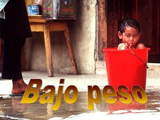 Bajo peso 