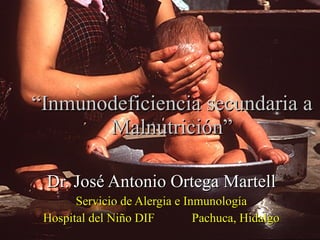 “ Inmunodeficiencia secundaria a Malnutrición” Dr. José Antonio Ortega Martell Servicio de Alergia e Inmunología Hospital del Niño DIF  Pachuca, Hidalgo 