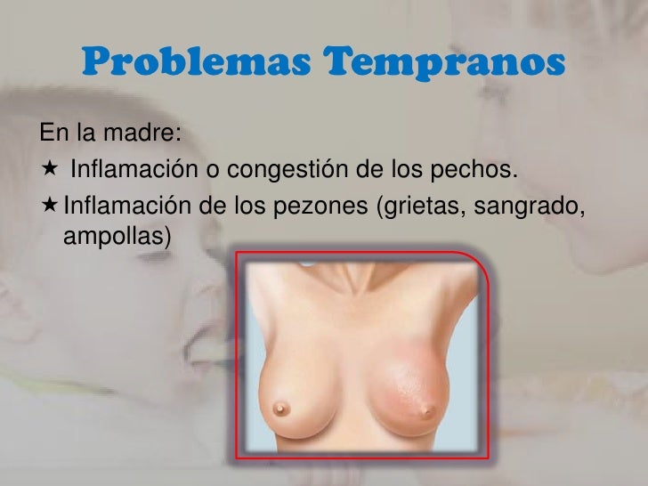 Quien ha aumentado independientemente el pecho