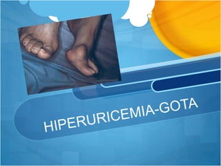 HIPERURICEMIA-GOTA 