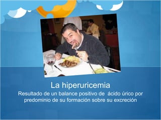 Resultado de un balance positivo de  ácido úrico por predominio de su formación sobre su excreciónLa hiperuricemia 