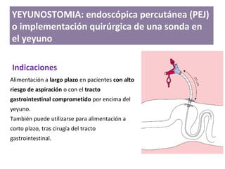 Alimentación a largo plazo en pacientes con alto
riesgo de aspiración o con el tracto
gastrointestinal comprometido por encima del
yeyuno.
También puede utilizarse para alimentación a
corto plazo, tras cirugía del tracto
gastrointestinal.
YEYUNOSTOMIA: endoscópica percutánea (PEJ)
o implementación quirúrgica de una sonda en
el yeyuno
Indicaciones
 