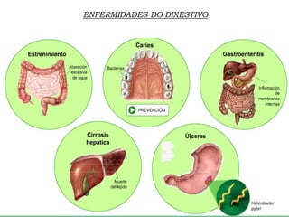 ENFERMIDADES DO DIXESTIVO
 