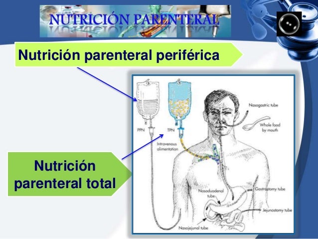 Nutricion parenteral total en adultos