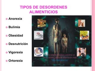 TIPOS DE DESORDENES
               ALIMENTICIOS
   Anorexia

   Bulimia

   Obesidad

   Desnutrición

   Vigorexia

   Ortorexia
 