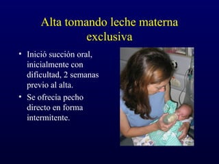 Alta tomando leche materna
exclusiva
• Inició succión oral,
inicialmente con
dificultad, 2 semanas
previo al alta.
• Se ofrecía pecho
directo en forma
intermitente.
 