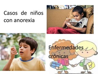 Casos de niños
con anorexia
Enfermedades
crónicas
 