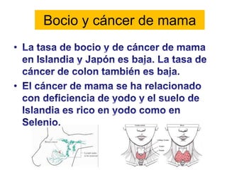 Bocio y cáncer de mama
 