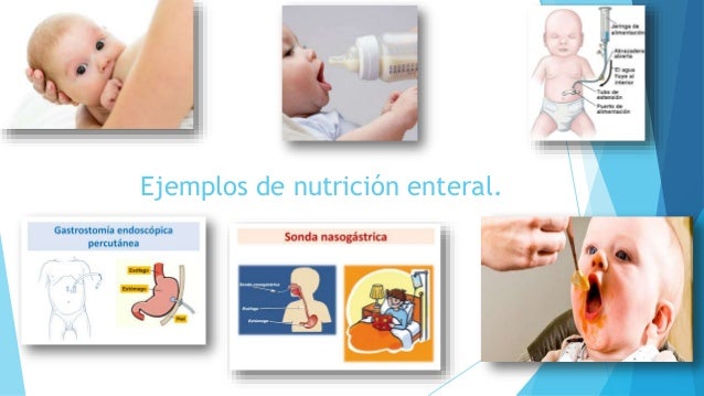 técnicas de alimentación asistida nutrición parenteral y técnicas de alimentación asistida nutrición parenteral y