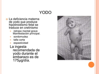 YODOLa deficiencia materna de yodo que produce hipotiroidismo fetal se traduce en cretinismo retraso mental grave      Manifestación principal. sordomudez talla corta  espasticidad La ingesta recomendada de yodo durante el embarazo es de 175µg/día.