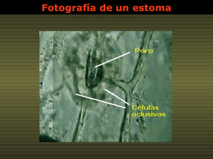 Fotografía de un estoma 