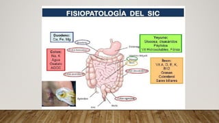 Fall Intestinal NUTRICIÓN EN FALLA INTESTINAL medicina | PDF