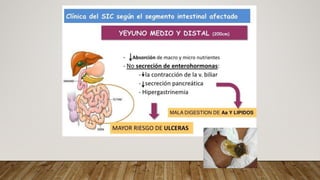 Fall Intestinal NUTRICIÓN EN FALLA INTESTINAL medicina | PDF