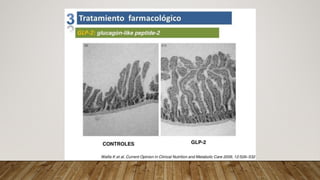 Fall Intestinal NUTRICIÓN EN FALLA INTESTINAL medicina | PDF
