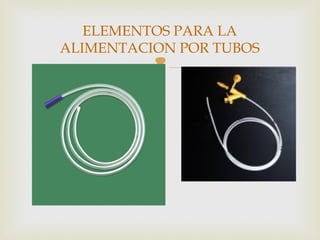
ELEMENTOS PARA LA
ALIMENTACION POR TUBOS
 