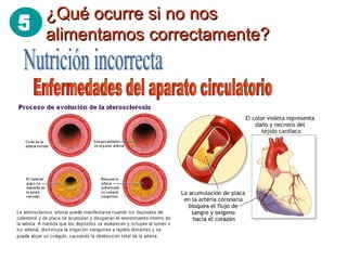 ¿Qué ocurre si no nos alimentamos correctamente? Nutrición incorrecta Enfermedades del aparato circulatorio 5 