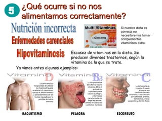¿Qué ocurre si no nos alimentamos correctamente? Nutrición incorrecta Escasez de vitaminas en la dieta. Se producen diversos trastornos, según la vitamina de la que se trate. Hipovitaminosis Ya vimos antes algunos ejemplos: RAQUITISMO  PELAGRA  ESCORBUTO Enfermedades carenciales Si nuestra dieta es correcta no necesitaremos tomar complementos vitamínicos extra. 5 