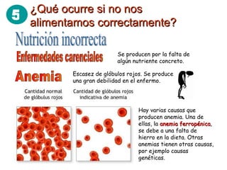 5 ¿Qué ocurre si no nos¿Qué ocurre si no nos
alimentamos correctamente?alimentamos correctamente?
Se producen por la falta de
algún nutriente concreto.
Escasez de glóbulos rojos. Se produce
una gran debilidad en el enfermo.
Hay varias causas que
producen anemia. Una de
ellas, la anemia ferropénicaanemia ferropénica,
se debe a una falta de
hierro en la dieta. Otras
anemias tienen otras causas,
por ejemplo causas
genéticas.
 