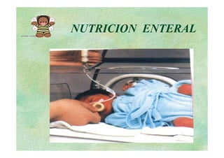 NUTRICION ENTERAL
 