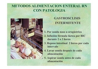 METODOS ALIMENTACION ENTERAL RN
         CON PATOLOGIA

                     GASTROSCLISIS
                     INTERMITENTE

             1. Por sonda naso u orogástrica
             2. Infusión fórmula láctea por BIC
                durante 2 a 3 horas
             3. Reposo intestinal 2 horas por cada
                intervalo
             4. Lavar sonda después de cada
                alimentación
             5. Aspirar sonda antes de cada
                alimentación
 