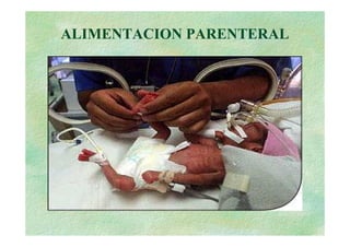 ALIMENTACION PARENTERAL
 