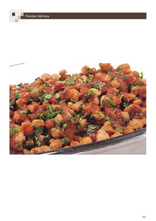 302
Flacidez dérmica
 