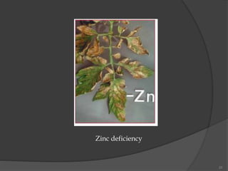 23
Zinc deficiency
 