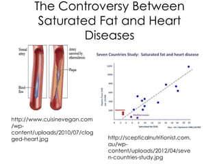 The Controversy Between
        Saturated Fat and Heart
                Diseases




http://www.cuisinevegan.com
/wp-
content/uploads/2010/07/clog
ged-heart.jpg                  http://scepticalnutritionist.com.
                               au/wp-
                               content/uploads/2012/04/seve
                               n-countries-study.jpg
 