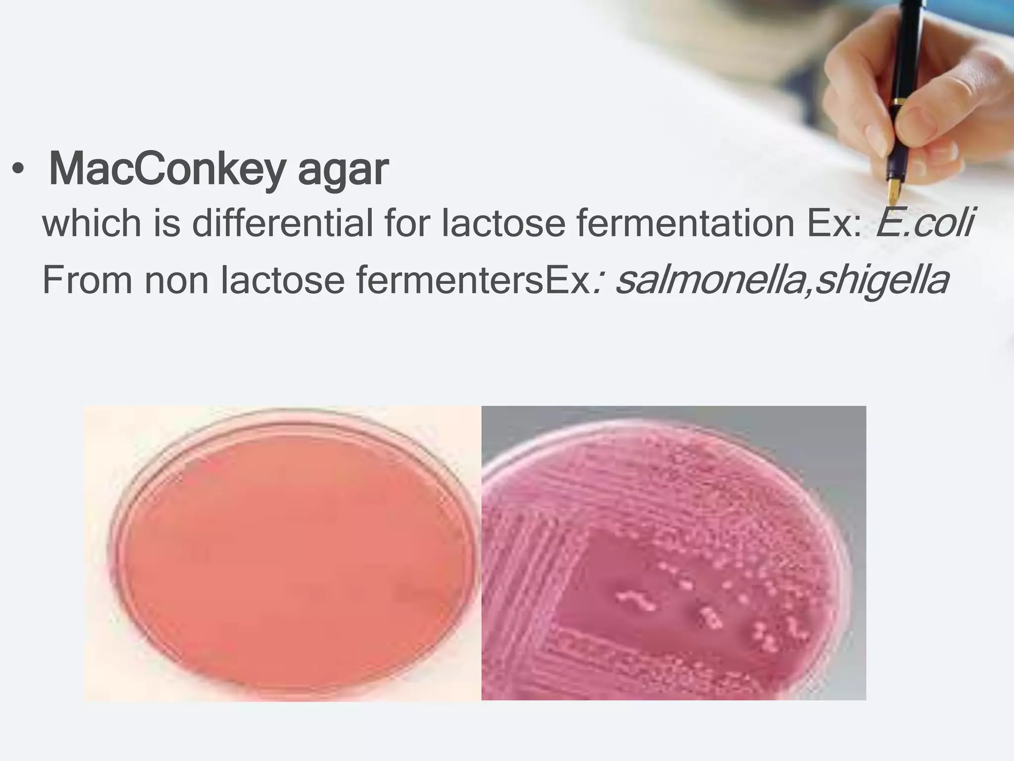 • MacConkey agar
which is differential for lactose fermentation Ex: E.coli
From non lactose fermentersEx: salmonella,shigella
 