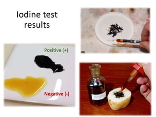 Iodine test
results
Positive (+)
Negative (-)
 