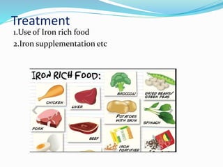 Treatment
1.Use of Iron rich food
2.Iron supplementation etc
 