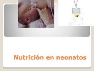 Nutrición en neonatos
 