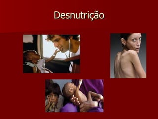 Desnutrição 