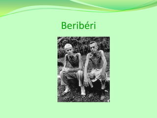 Beribéri

 